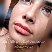 AUMENTO DE LABIOS EN SPA LEYDIS MARIANAO - Img 57732445