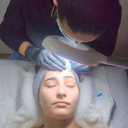 ✨ LIMPIEZA FACIAL PROFUNDA EN LA HABANA ✨ - Img 57445454