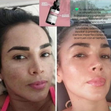 Tónico LB aclarante Anti-Imperfecciones despigmentante quita y aclara manchas uso nocturno todo el cuerpo - Img 117119596
