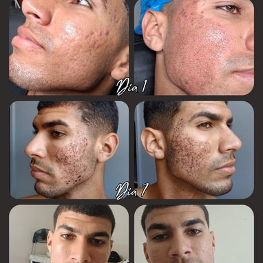 Spa_ leydis 🪷 ubicado en Marianao donde resaltamos tu belleza de forma natural. - Img 127551504