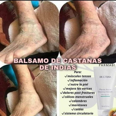 Gel de masaje ideal para mejorar la apariencia de las varices. - Img 121033023
