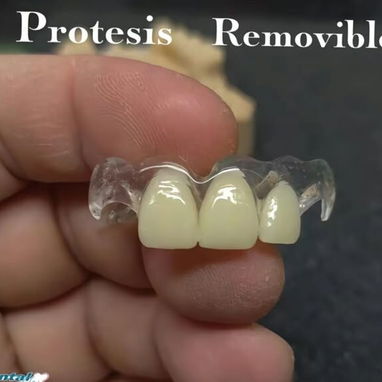 Prótesis removible - 2/2