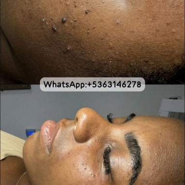 Tratamientos faciales y corporales - Img 122479301