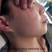 hilos de proteina de colageno para el rostro tratamientos anti arrugas - Img 44750163