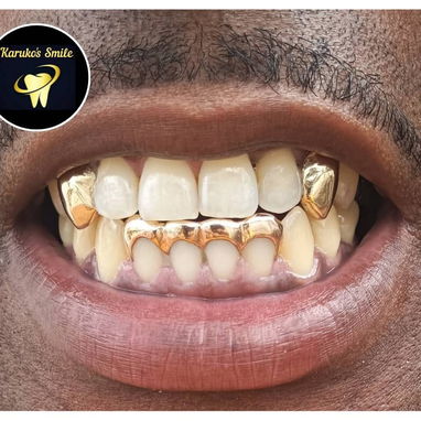 ✨💯Karuko Smiles 🤩✨Sonríe con estilo, Brilla con 🥇✨ Ponte pill@ 😁💪🏻 - 8/10