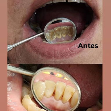 No se lo pierda , servicio de estética dental - Img 93032215