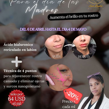 💉 Descubre el poder de la técnica de 4 puntos con ácido hialurónico y el aumento de labios en Spa Leydis Marianao 🌸 - Img 121800209