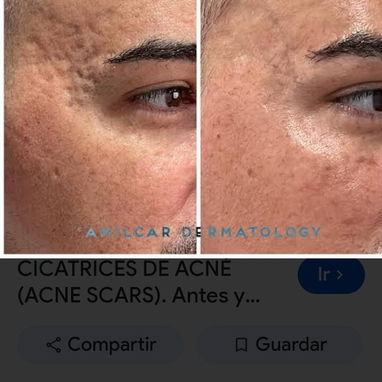Gel de Cicatrices Cicatricure adiós Cicatrices de Operaciones y Accidentes - 2/8
