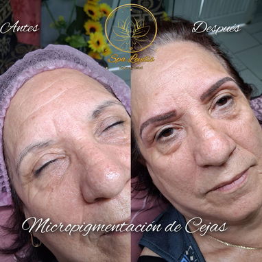 🔥 ¡CAMBIA TU ROSTRO, ELEVA TU BELLEZA HOY! 🔥 ¿Lista para verte más joven, radiante y segura desde la primera sesión? - Img 121663395