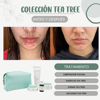 ¡Bálsamo Tea Tree de Dr. C. Tuna by Farmasi! 🌿✨ - Img 113556441