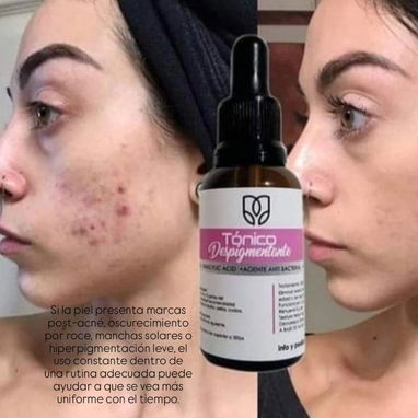 Tónico LB aclarante Anti-Imperfecciones despigmentante quita y aclara manchas uso nocturno todo el cuerpo - Img 117119595