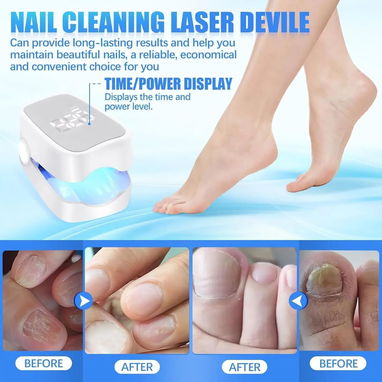 Dispositivo LED/UV para Hongos en Uñas 🦶 Tratamiento Portátil – USB Recargable, Sesiones 7 Min, Mejora Estética en Mano - Img 123060245