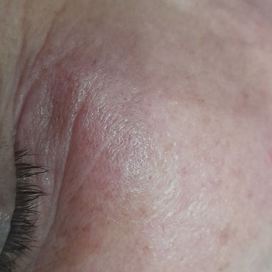 Masajes / limpieza de Espalda/ limpieza facial profunda / pedicura hidratante - Img 124909680