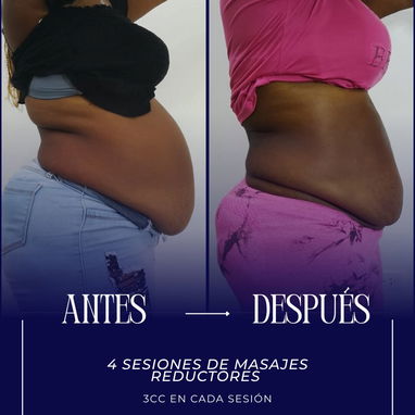 MASAJES REDUCTORES EN LA HABANA | MOLDEO CORPORAL | MADEROTERAPIA - 4/6