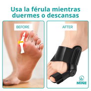 🦶✅ Corrector de Juanetes Ajustable 👣 | Alivio del Dolor 💤 | LA PAREJA 🔧 | Uso Día y Noche 🌙 - - Img 51700873
