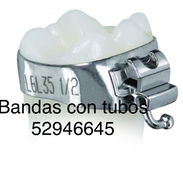 Bandas molares para tratamiento de ortodoncia - Img 53790331