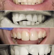 Especialista en Estomatología y ofrezco servicios para que tengas una sonrisa saludable y radiante. - Img 50705392