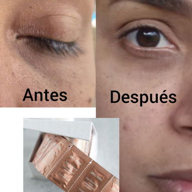Botox instantáneo Farmasi - Img 120231837