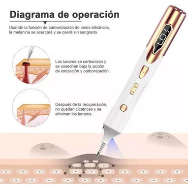 Cauterizador Quita Verrugas, Manchas, Pecas 58757374 - Img 76586212