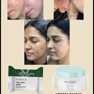 Productos de nutrición y belleza - 8/10