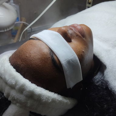 Limpieza facial profunda con Aparatologia - Img 122928356