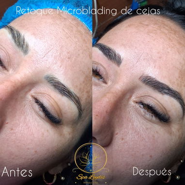 🔥 ¡CAMBIA TU ROSTRO, ELEVA TU BELLEZA HOY! 🔥 ¿Lista para verte más joven, radiante y segura desde la primera sesión? - Img 121663386