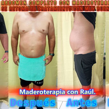 Masajista y Maderoterapeuta. En Spa Leydis brindamos múltiples servicios. Los esperamos. - Img 127881808
