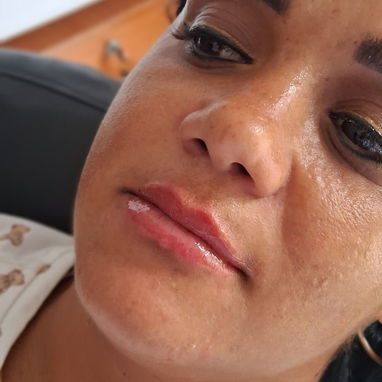 Aumento de labios con ácido hialurónico en Spa_leydis🪷 Marianao. Resalta su belleza de forma natural - Img 128015153