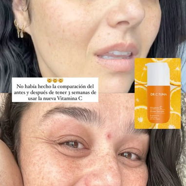 Vitamina C corporal de farmasi - Img 121963919
