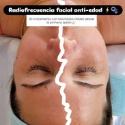 TRATAMIENTOS FACIALES Y LIMPIEZAS FACIALES EN TU PROPIA CASA🚗🫧🧴 - Img 56206726
