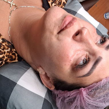 💉 Descubre el poder de la técnica de 4 puntos con ácido hialurónico y el aumento de labios en Spa Leydis. Ubicado en Ma - Img 121316459