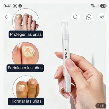 Fuera Uñas Enfermas en Manos y Pies, Lápiz Seralia Anti Hongos - 4/8