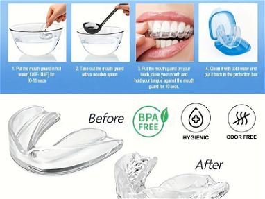 Ferula bucal para protección anti bruxismo dental - Img 51685995