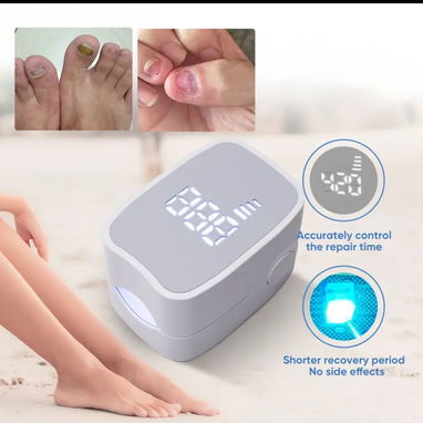📌Tratamiento láser ⚡️ UV contra hongos en las uñas de los  🦶y manos 🤚 - Img 122644119
