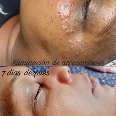 Tratamientos faciales y corporales - Img 122479527