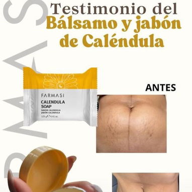 🌼 Jabón de Caléndula Dr. C. Tuna Farmasi | Jabón Natural Cara y Cuerpo | Piel Sensible - Img 121056465