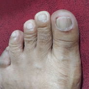 SERVICIO DE PEDICURA A DOMICILIO PARA PERSONAS MAYORES - Img 54836709