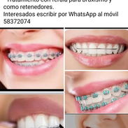 Servicios de estomatología - Img 56043312