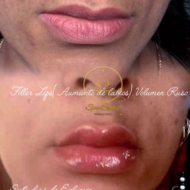 💋 Labios que hablan por ti Más volumen, más hidratación y una forma que realza tu belleza natural ✨ - Img 118844634