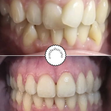 Servicios Dentales / Ortodoncia /Carillas/Prótesis - Img 124512746