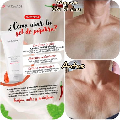 Gel para la flacidez y tonificar la piel - Img 112531996