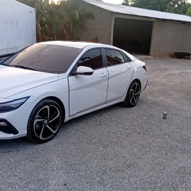 🚨🔥 ¡EL HYUNDAI ELANTRA 2025 MÁS ECONÓMICO DE LA HABANA! 🔥🚨 - 2/8