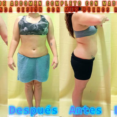 Masajista y Maderoterapeuta. En Spa Leydis brindamos múltiples servicios. Los esperamos. - Img 127881809