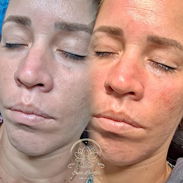 Spa_ leydis 🪷 ubicado en Marianao donde resaltamos tu belleza de forma natural. - Img 56739453
