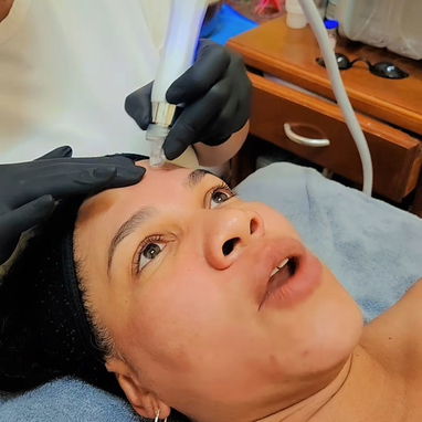✨ LIMPIEZA FACIAL PROFUNDA EN LA HABANA ✨ - 9/10