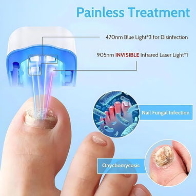 Dispositivo LED/UV para Hongos en Uñas 🦶 Tratamiento Portátil – USB Recargable, Sesiones 7 Min, Mejora Estética en Mano - Img 123060240