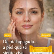 🌼✨ ¡Dale a tu piel el cuidado que merece con el jabóndeCaléndula! ✨🌼 - Img 55831848