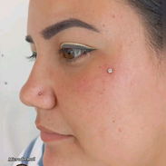 Perforaciones Kary/ Piercing Microdermales/ Sharoski - Img 57493210