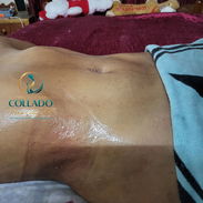 ✅ DRENAJE LINFÁTICO POST QUIRÚRGICOS MASAJES POST OPERATORIO APARATOLOGIA ASESORÍA DOMICILIO GRATIS - Img 56019832