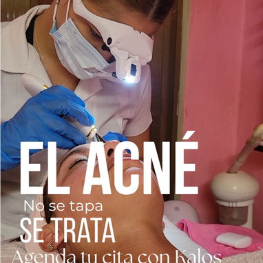 TRATAMIENTOS FACIALES Y LIMPIEZAS FACIALES EN TU PROPIA CASA🚗🫧🧴 - Img 125182528